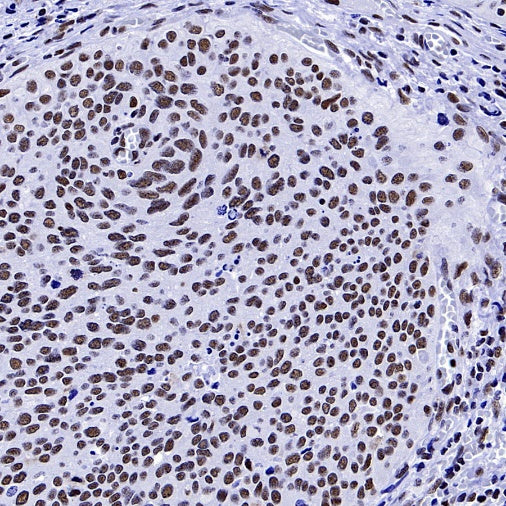 WTAP Recombinant Rabbit mAb (S-2741-49)