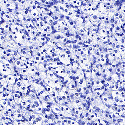 BSND Recombinant Rabbit mAb (S-3815-70)