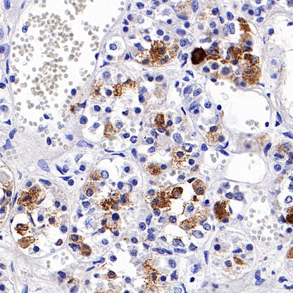 S-RMab® FSHB Recombinant Rabbit mAb (SDT-544-22)