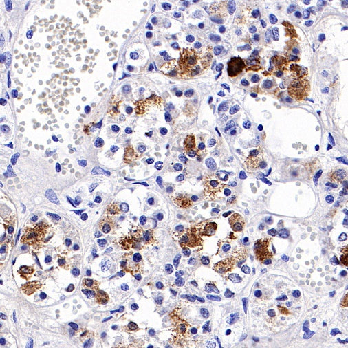 S-RMab® FSHB Recombinant Rabbit mAb (SDT-544-22)