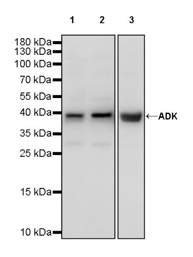 ADK Rabbit Polyclonal Antibody