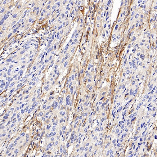 MMP2 Recombinant Rabbit mAb (S-1804-55)