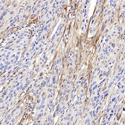 MMP2 Recombinant Rabbit mAb (S-1804-55)