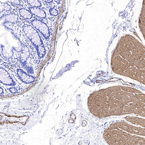 Calponin-1 Recombinant Rabbit mAb (S-R161)
