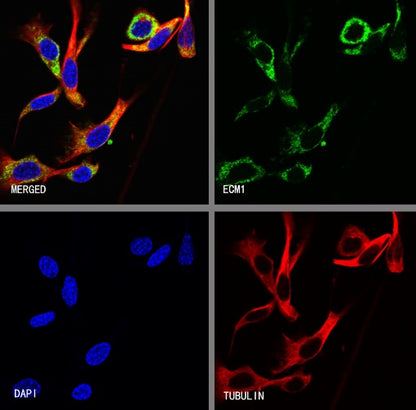 ECM1 Recombinant Rabbit mAb (S-2235-35)