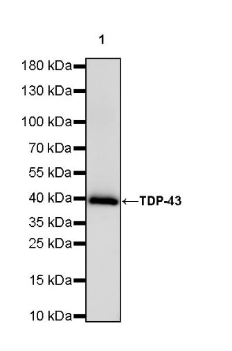 TDP-43 Recombinant Rabbit mAb (S-989-41)