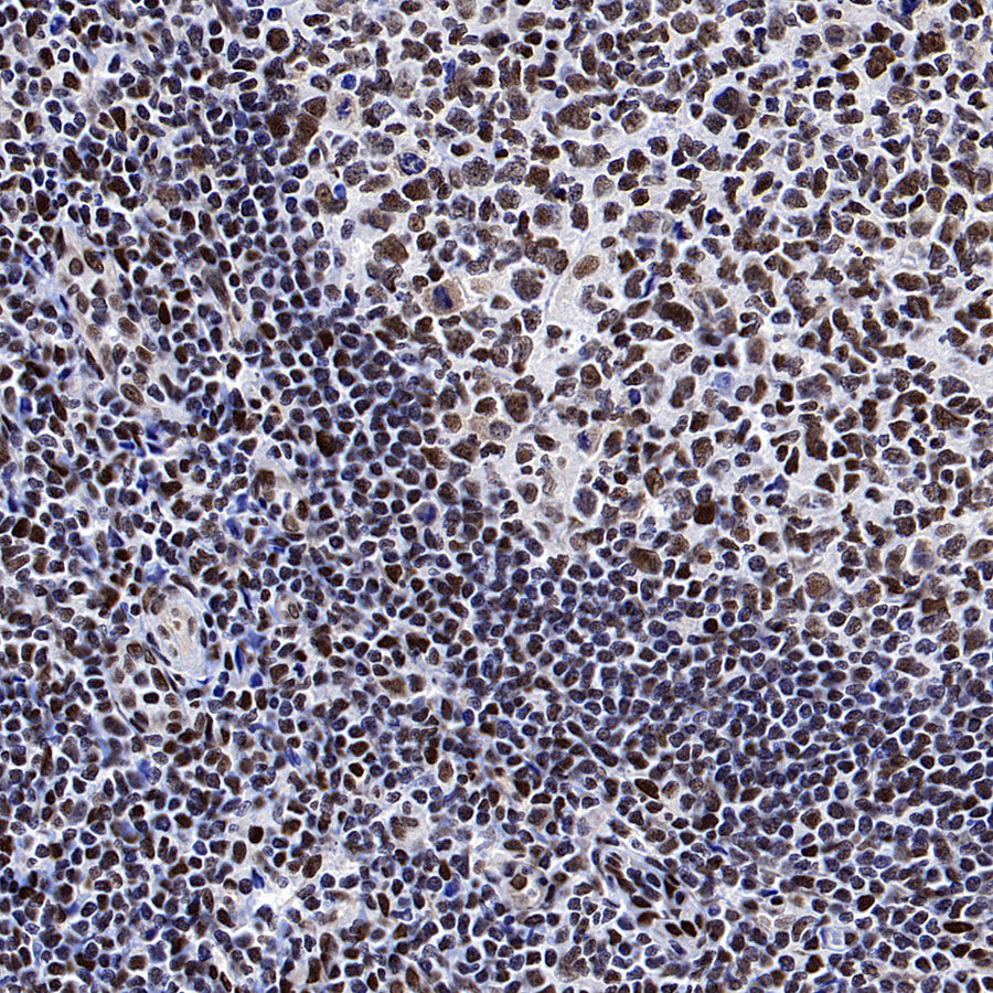 53BP1 Recombinant Rabbit mAb (S-3170-149)