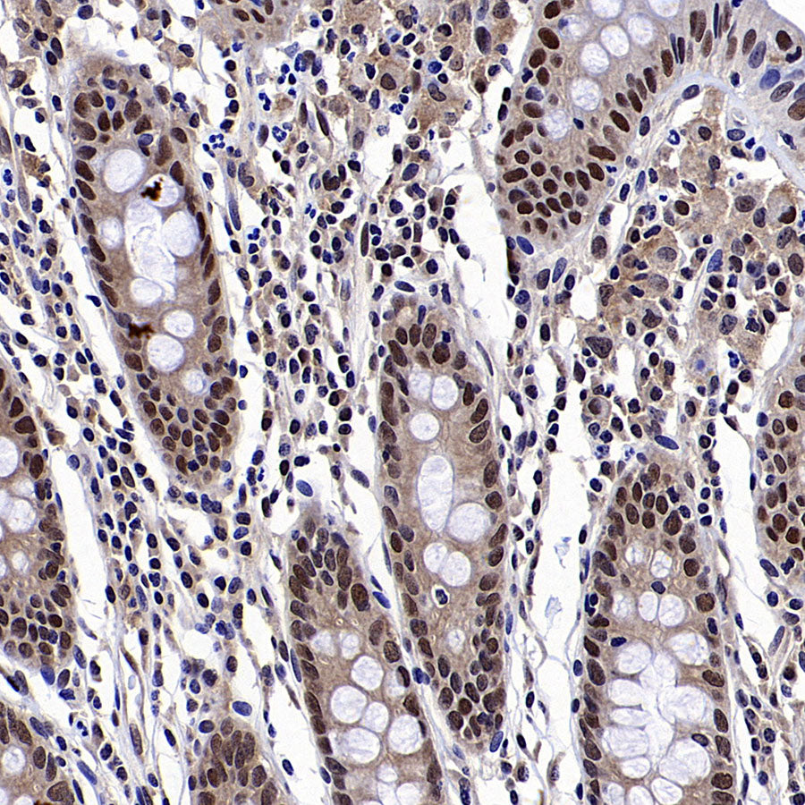 DCAF8 Recombinant Rabbit mAb (S-3483-11)