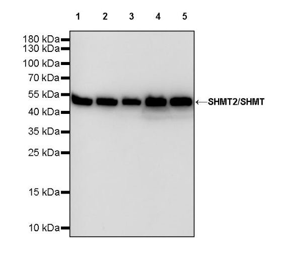 SHMT2/SHMT Recombinant Rabbit mAb (S-1581-5)