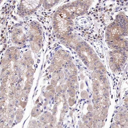 IDE Recombinant Rabbit mAb (S-1051-61)