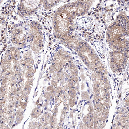 IDE Recombinant Rabbit mAb (S-1051-61)