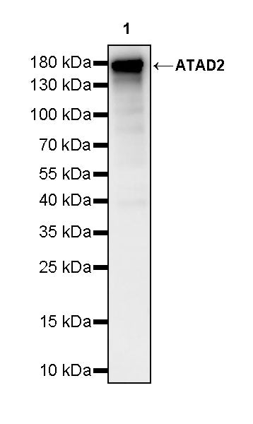 ATAD2 Recombinant Rabbit mAb (S-4145-63)