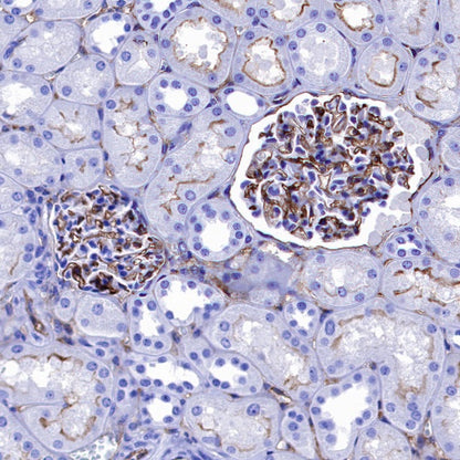 ICAM-1/CD54 Recombinant Rabbit mAb (S-906-48)