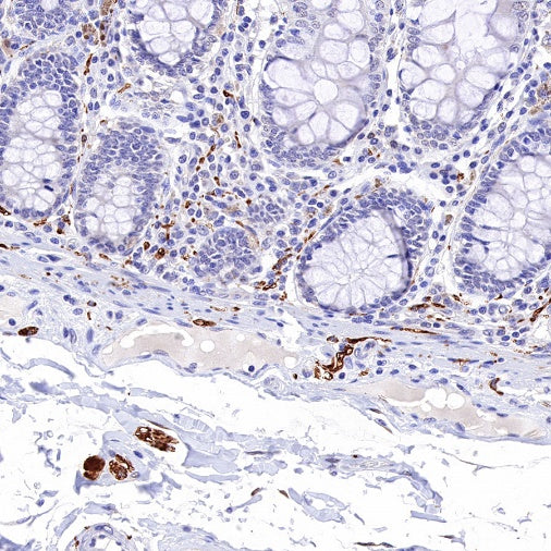 PGP9.5 Recombinant Rabbit mAb (SDT-665-37)