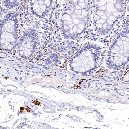 PGP9.5 Recombinant Rabbit mAb (SDT-665-37)