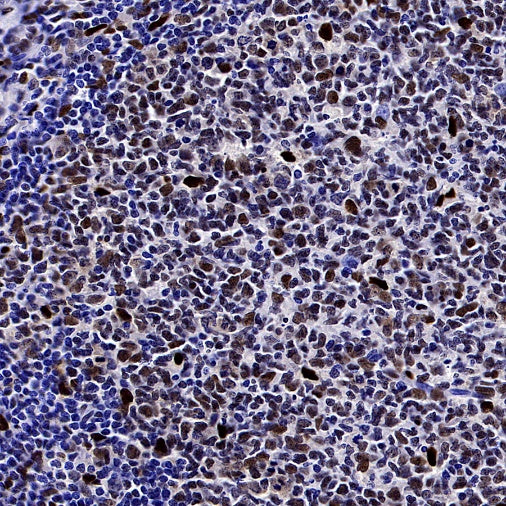 DLX5 Recombinant Rabbit mAb (S-2785-79)