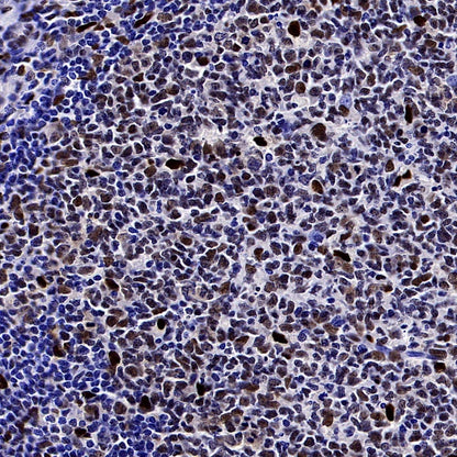 DLX5 Recombinant Rabbit mAb (S-2785-79)