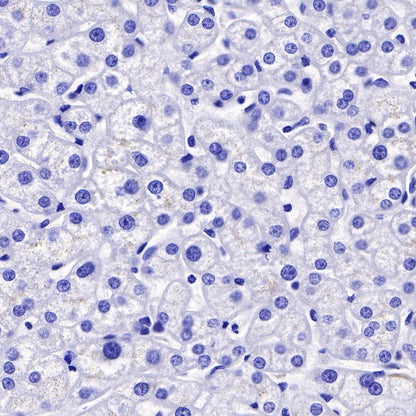 Uroplakin III Recombinant Rabbit mAb (SDT-R177)