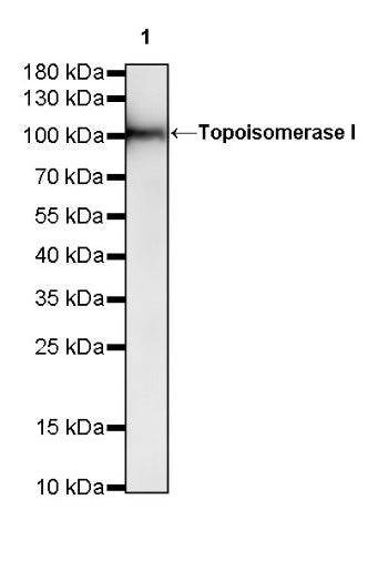 S-RMab®Topoisomerase I Recombinant Rabbit mAb (S-R209)