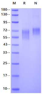 EGFRvIII His Tag Protein, Human