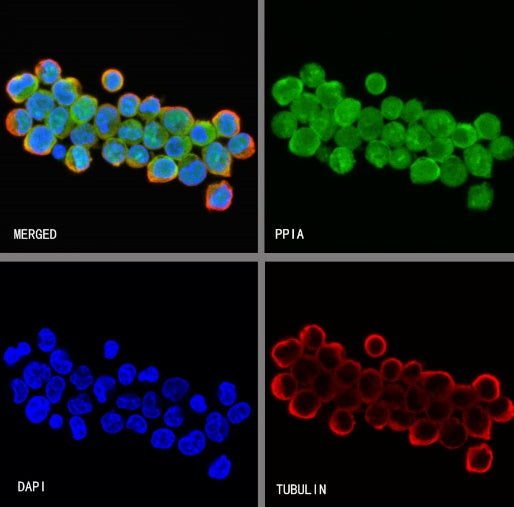 PPIA Recombinant Rabbit mAb (S-2406-28)