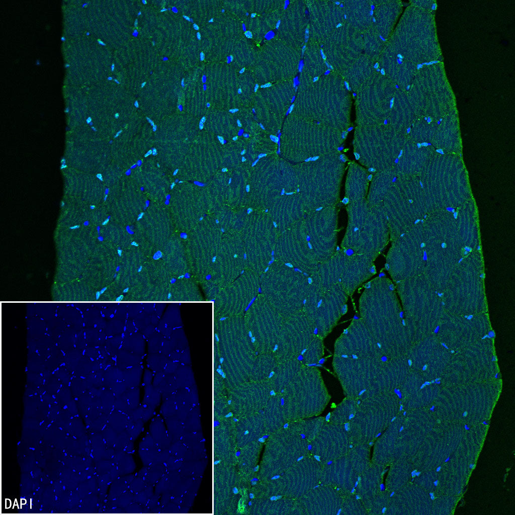 Myoglobin Recombinant Rabbit mAb (S-6197)