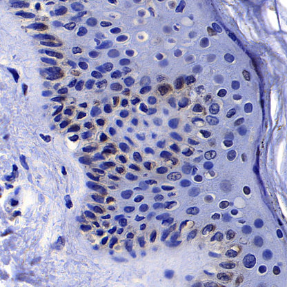 Gli2 Recombinant Mouse mAb (S-5691)