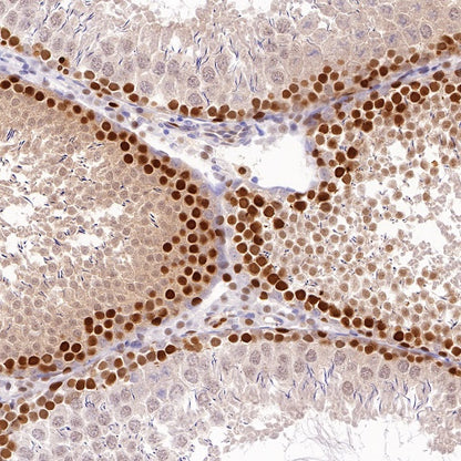 PCNA Recombinant Rabbit mAb (SDT-297-116)