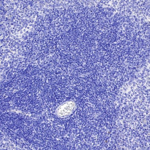 TRPV4 Recombinant Rabbit mAb (S-1746-65)