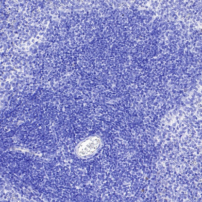 TRPV4 Recombinant Rabbit mAb (S-1746-65)