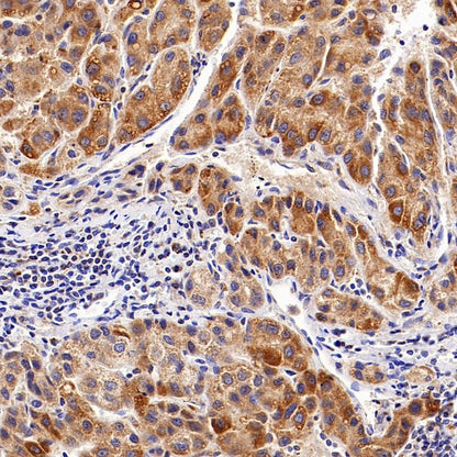 AIFM2/FSP1 Recombinant Rabbit mAb (S-2271-67)