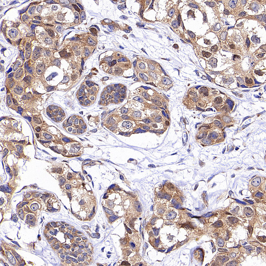 RPLP0 Rabbit Polyclonal Antibody