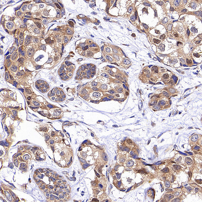RPLP0 Rabbit Polyclonal Antibody