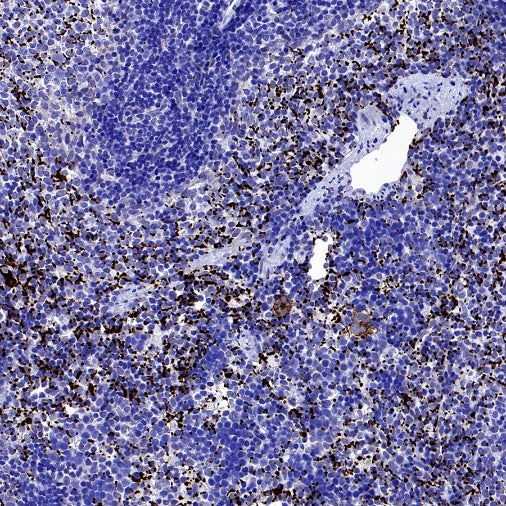 CD61 Recombinant Rabbit mAb (S-2515-6)