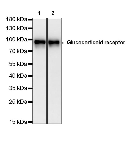 Glucocorticoid receptor Mouse mAb