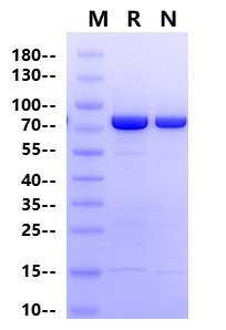 ACSS2 His Tag Protein, Human