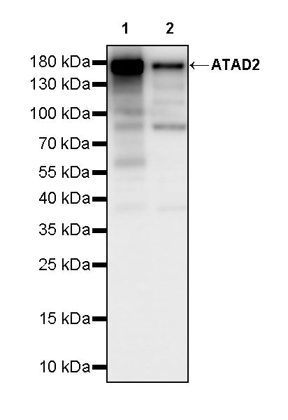 ATAD2 Recombinant Rabbit mAb (S-4145-63)