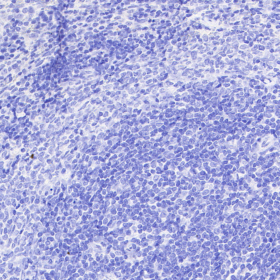 ITPR1 Recombinant Rabbit mAb (S-4530-5)