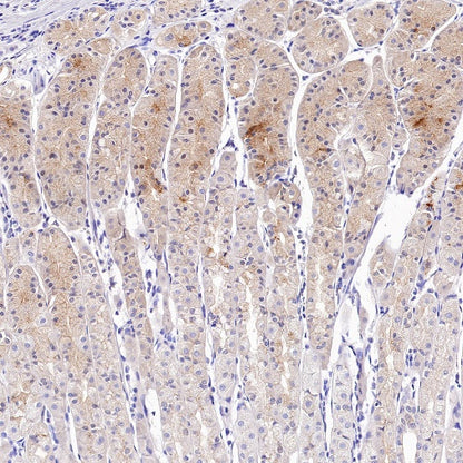 Tuberin/TSC2 Recombinant Rabbit mAb (S-1138-125)