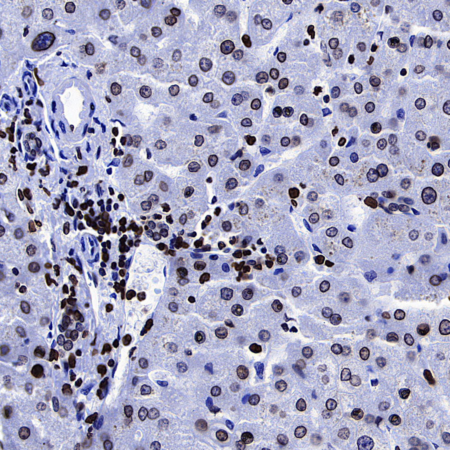 Lamin B1 Recombinant Rabbit mAb (S-5361)