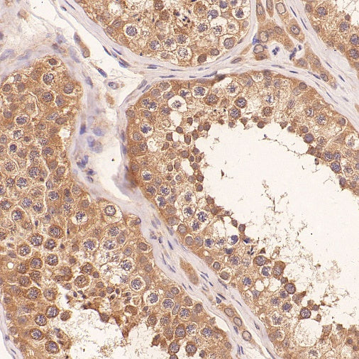 IFT88 Recombinant Rabbit mAb (S-2187-107)