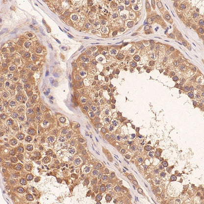 IFT88 Recombinant Rabbit mAb (S-2187-107)