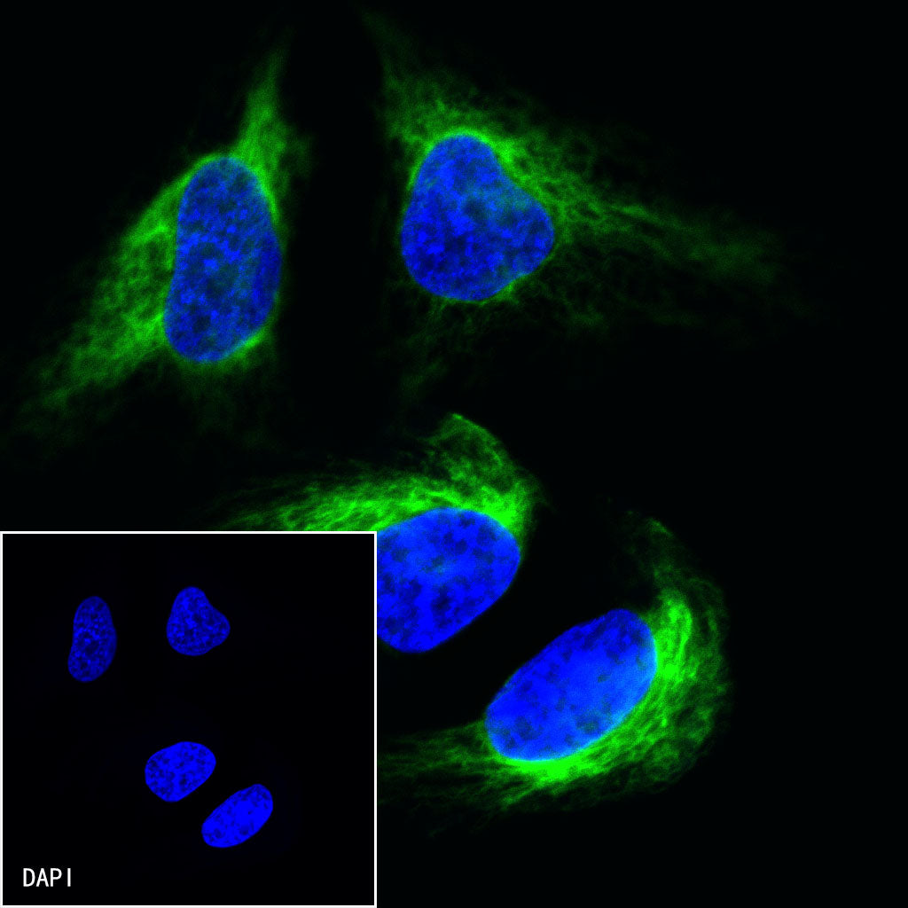 Vimentin Recombinant Rabbit mAb,PBS Only (SDT-029-20)