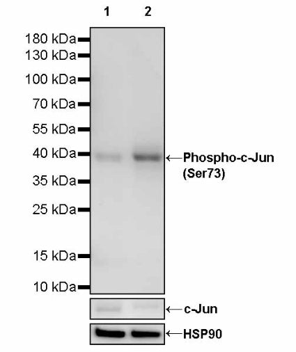 Phospho-c-Jun (Ser73) Recombinant Rabbit mAb (S-3105-71)
