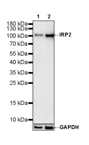IRP2 Recombinant Rabbit mAb (S-4592-56)