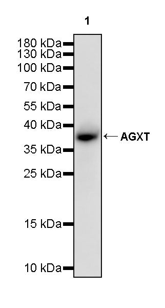 AGXT Recombinant Rabbit mAb (S-3586-30)