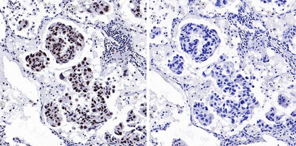 Phospho-NRF2 (Ser40) Recombinant Rabbit mAb (S-1720-97)