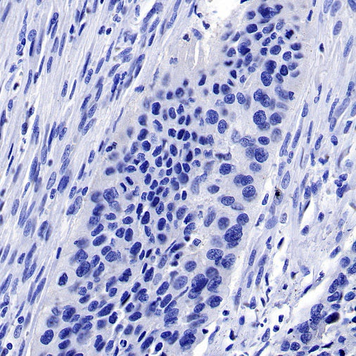 PMEL/Melanoma gp100 Recombinant Rabbit mAb (SDT-434-70)