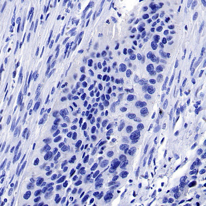 PMEL/Melanoma gp100 Recombinant Rabbit mAb (SDT-434-70)