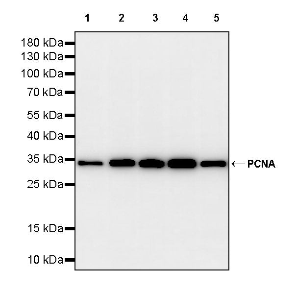 PCNA Recombinant Rabbit mAb (S-5313)